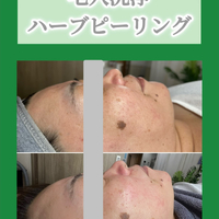 画像1512