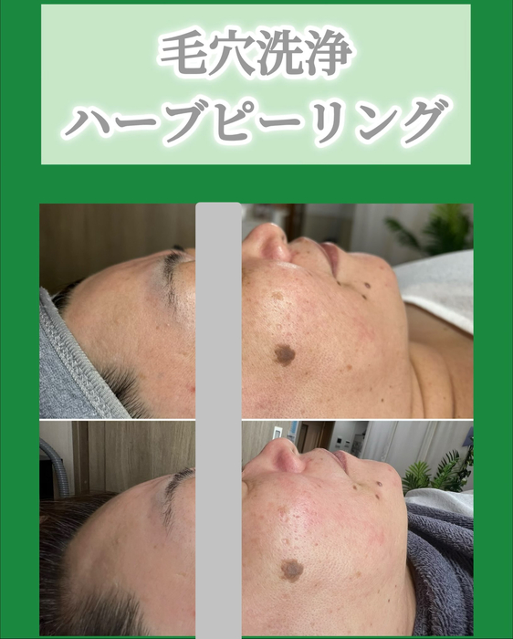 画像1512