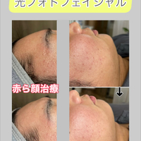 画像1515