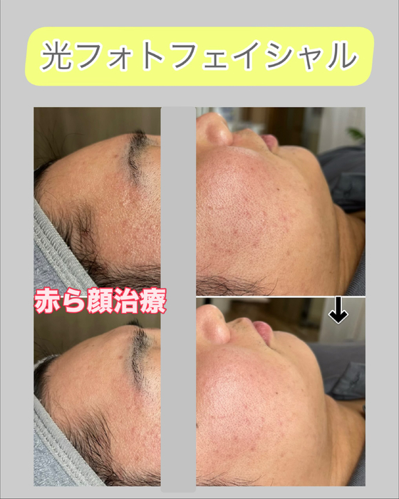 画像1515