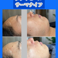 画像1517
