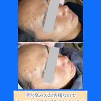 画像1518
