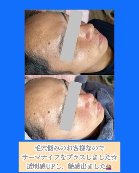 画像1518