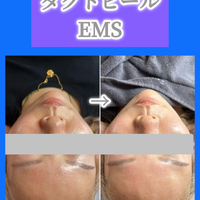 画像1520