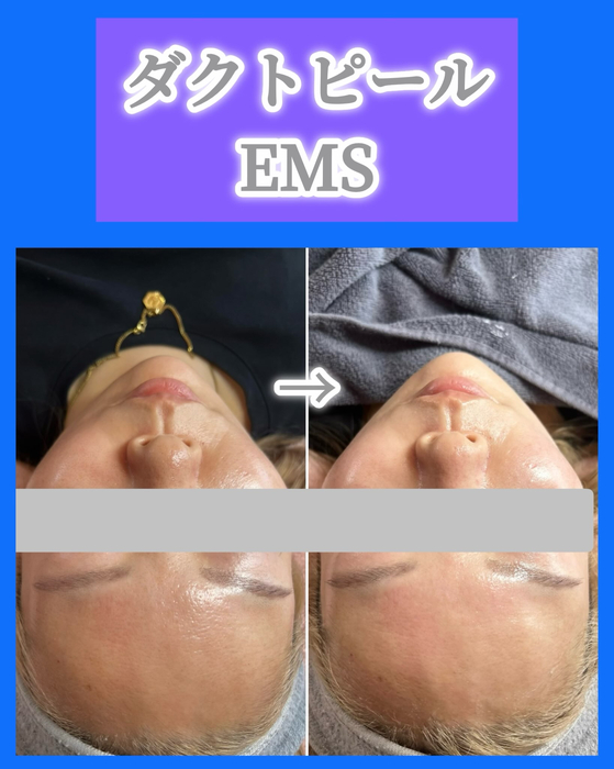 画像1520