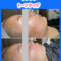 画像1521