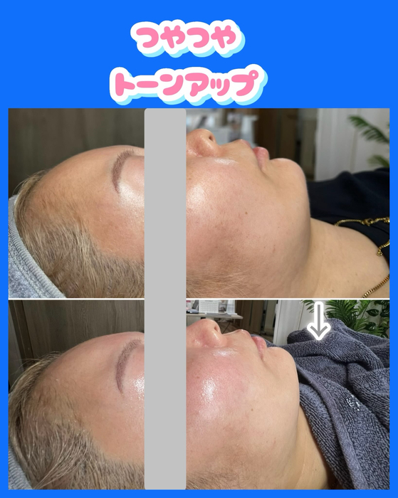 画像1521