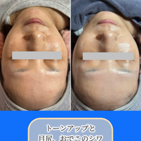 画像1525