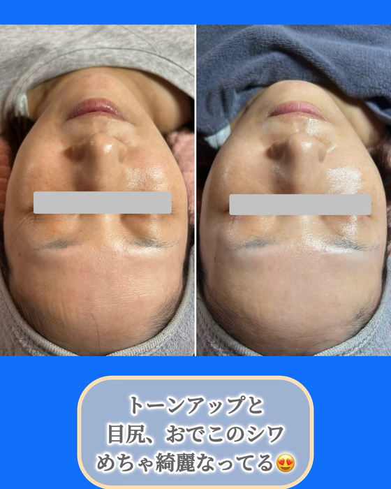 画像1525