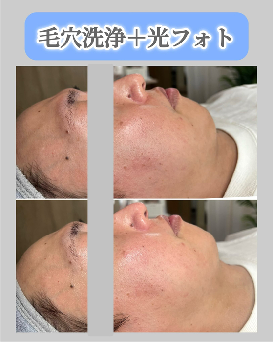 画像1529