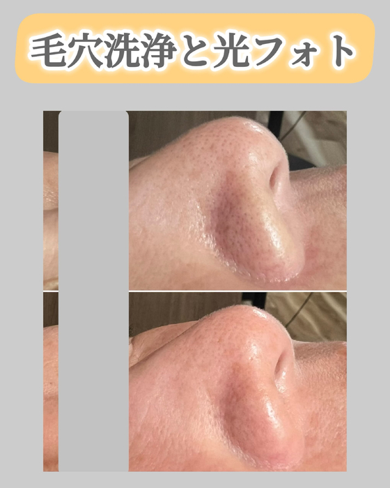 画像1532
