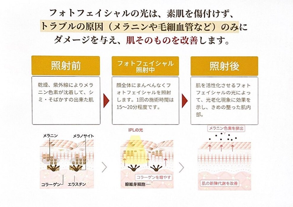 画像290