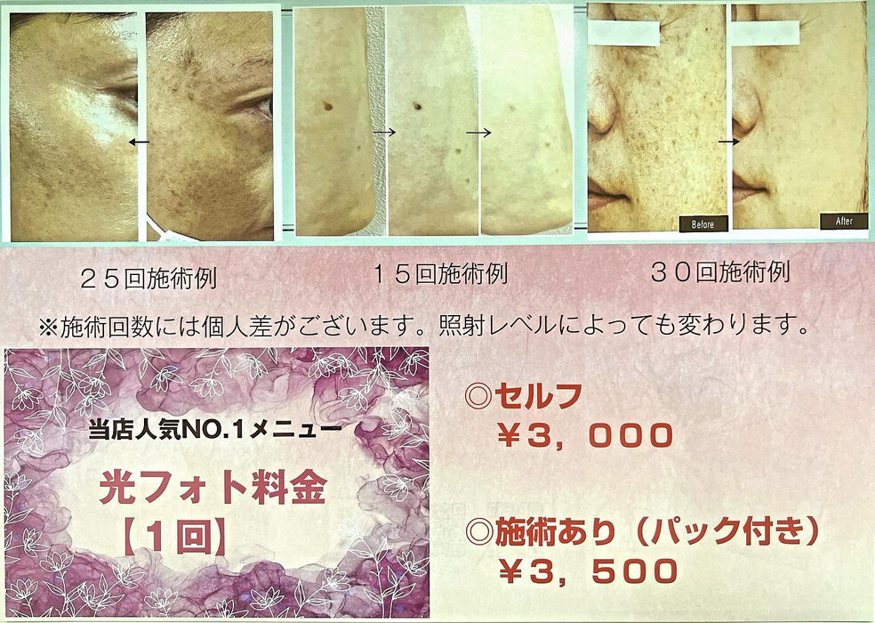 画像445