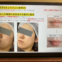 画像522