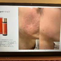 画像523