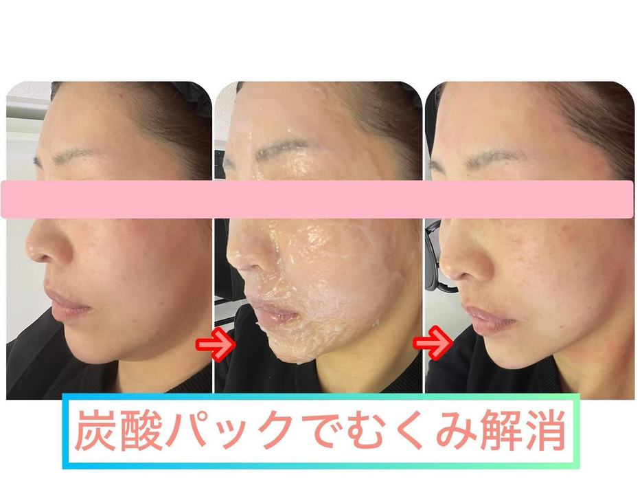 画像553
