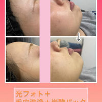 画像732