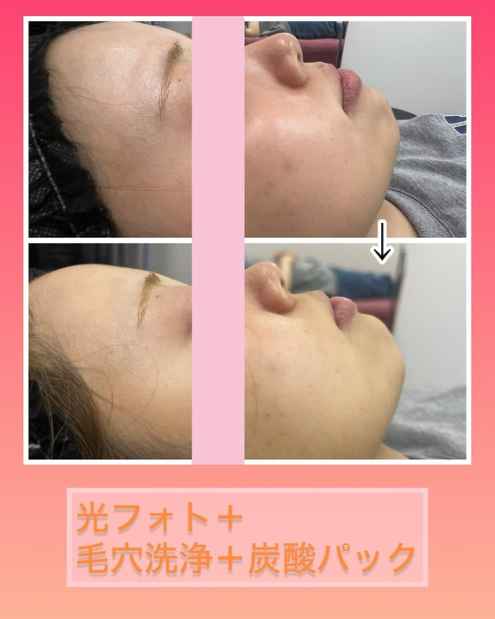 画像732