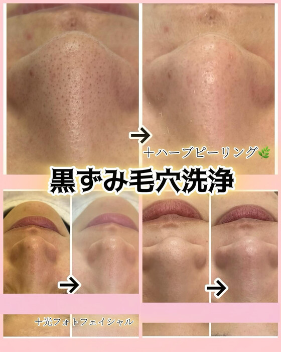 画像734