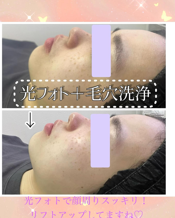 画像745
