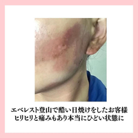 画像816