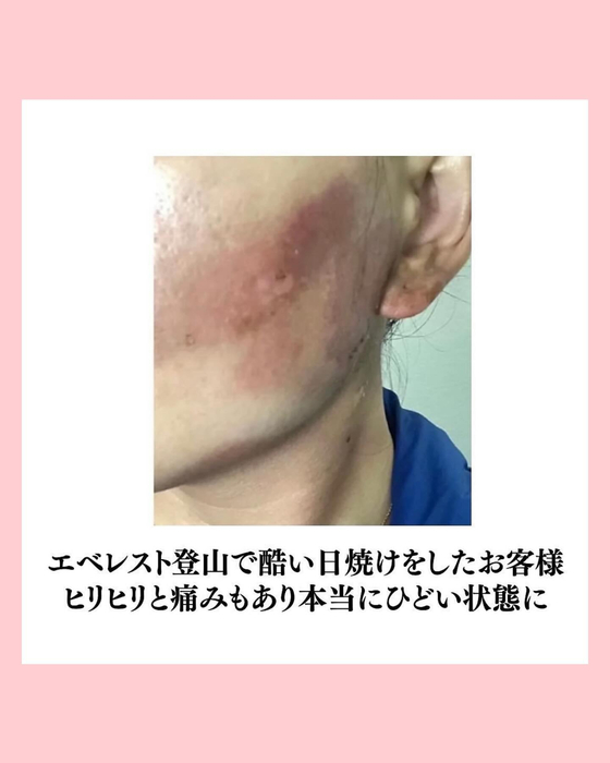 画像816