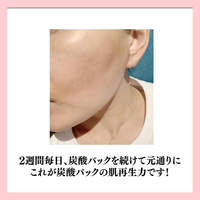 画像817
