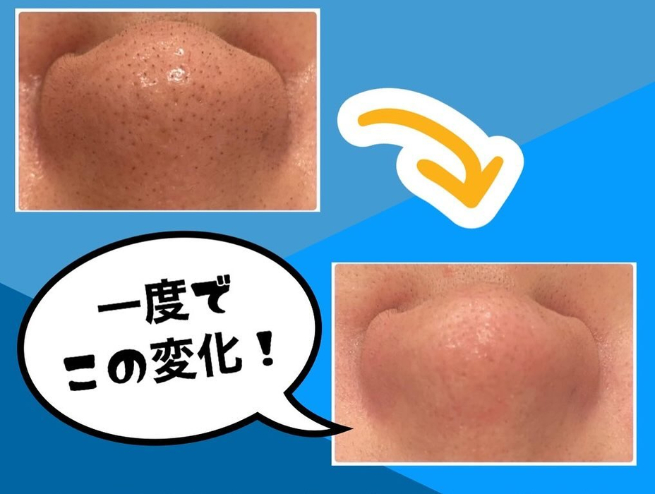 画像862