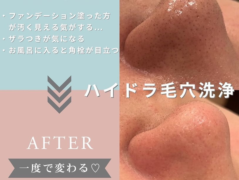 画像863