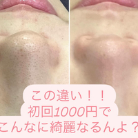 画像864