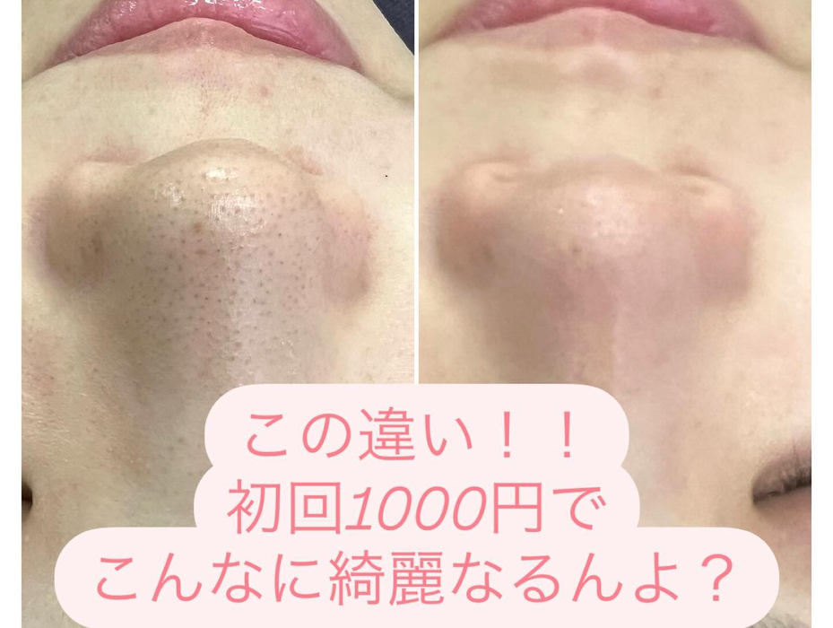 画像864