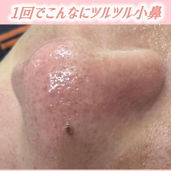 画像874
