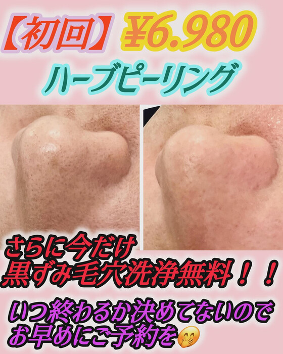 画像878