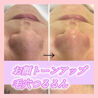 画像886