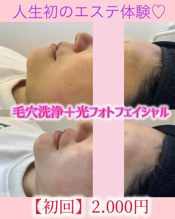 画像905