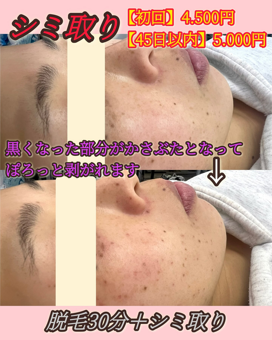 画像951