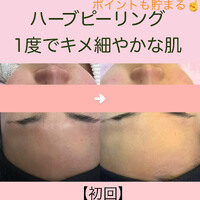 画像956
