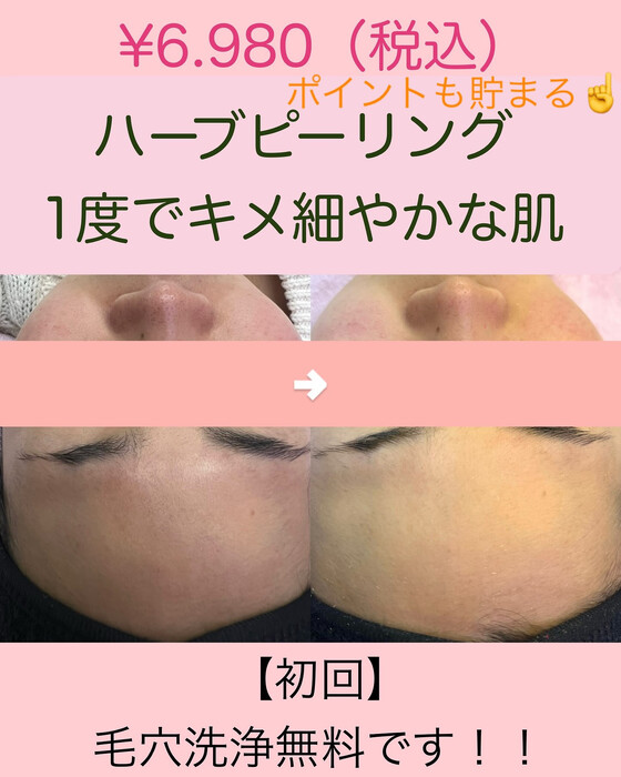 画像956