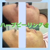 画像968