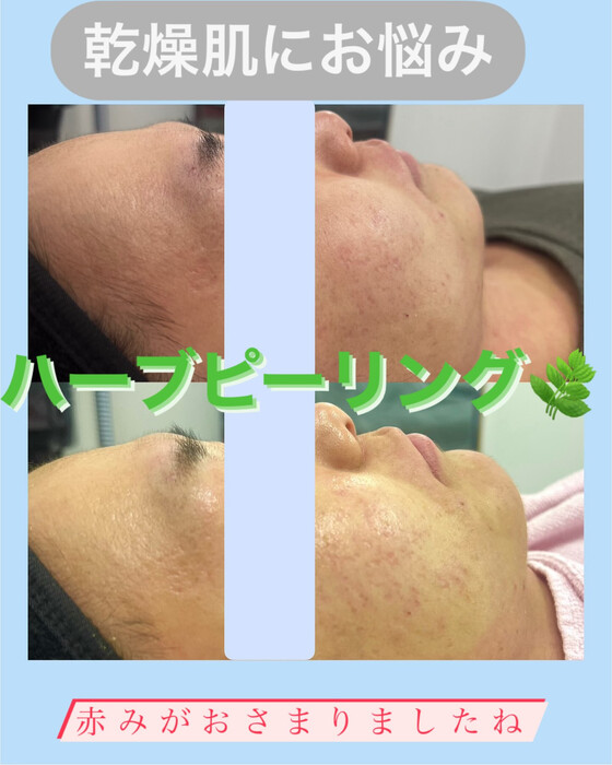 画像968